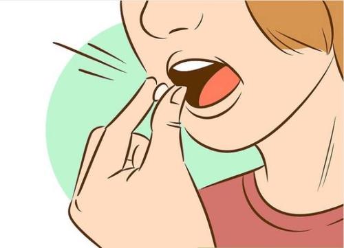 女性手臂上得了牛皮癣还能够治好吗