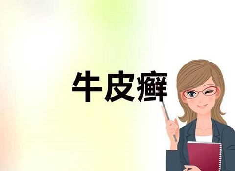牛皮癣康复后会复发吗