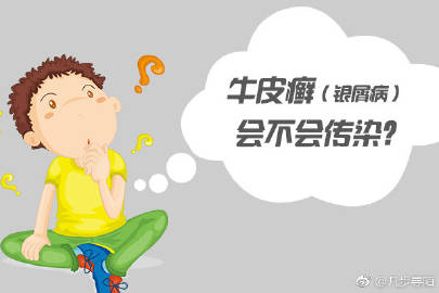 鱼鳞病会有哪些危害