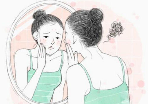 牛皮癣为啥严重了