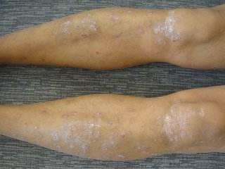 u=3432544854,2839153995&fm=253&fmt=auto&app=138&