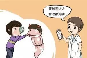 牛皮癣不同部位的临床症状