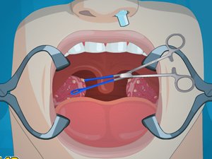 小苏打可以美白牙齿吗