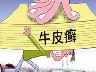不小心患上了牛皮癣是什么症状