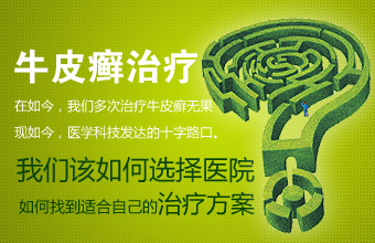 面对牛皮癣产生的危害我们该从何处下手