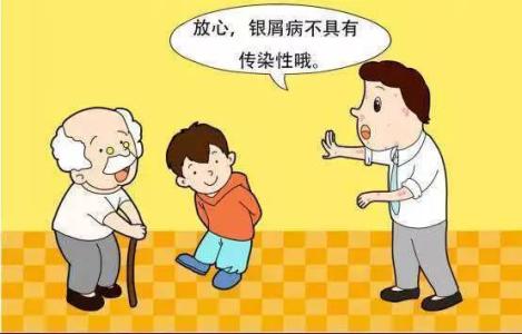 牛皮癣会不会传染