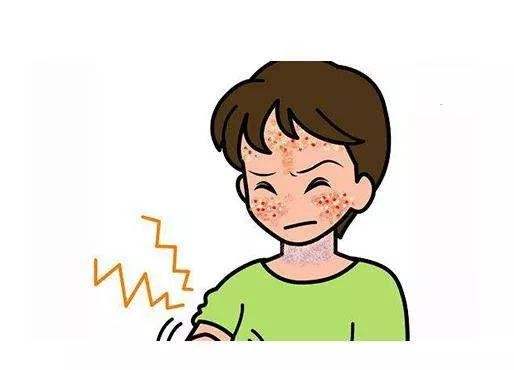 牛皮癣夏季加重的原因是什么