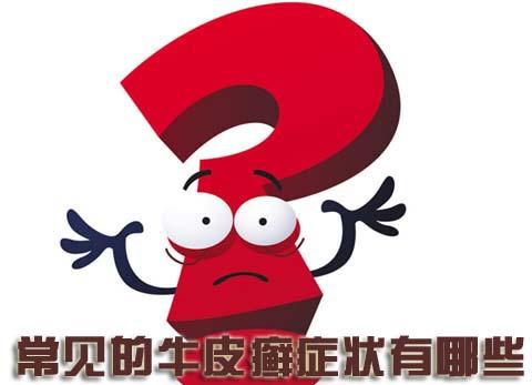 有多少患者知道这些偏方治疗牛皮癣